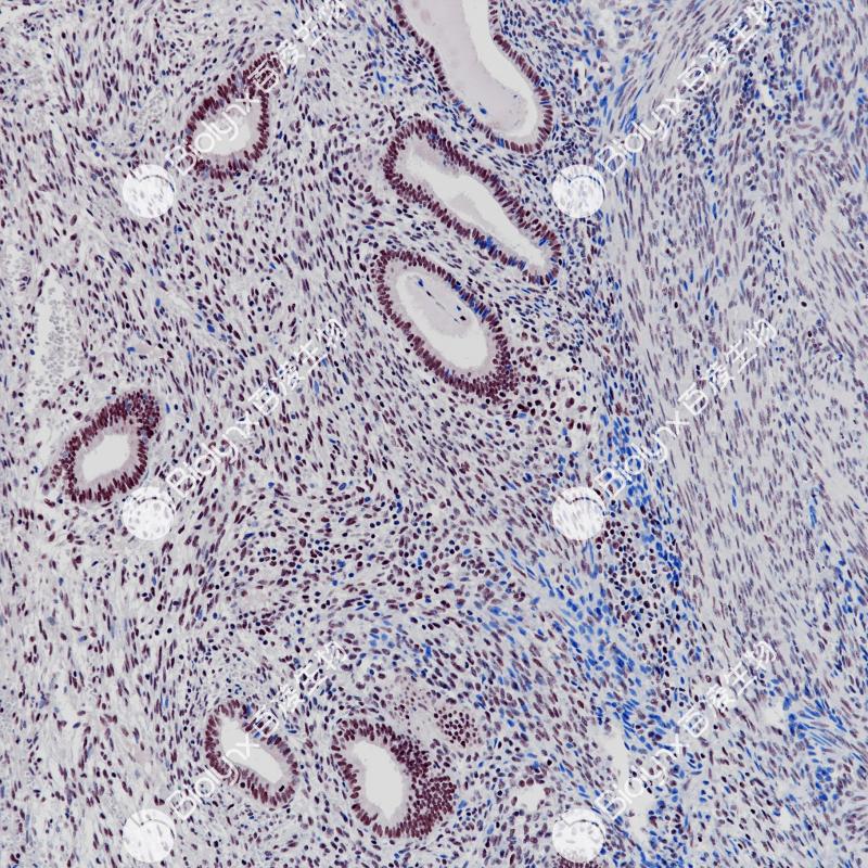 子宫内膜E2F4（BP6256）染色