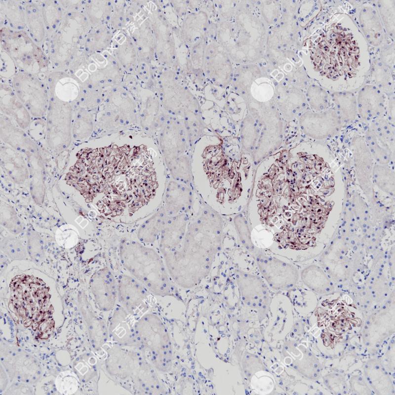 肾COL4A3（BP6254）染色