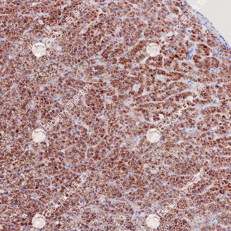 肾上腺皮脂腺瘤StAR（BP6262）染色