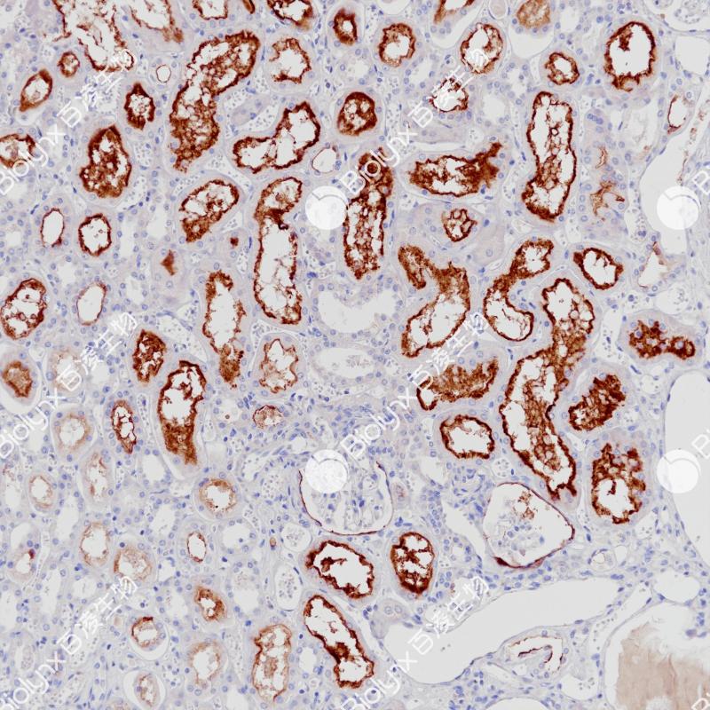 肾MDR-1（BP6260）染色