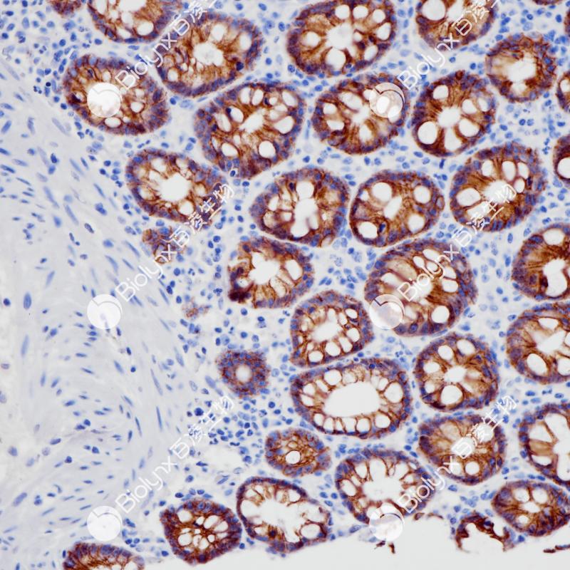 结肠CDH17(BP6266)染色