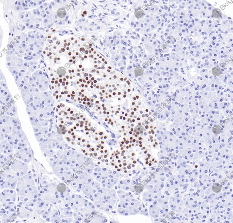 胰腺Islet-1（BP6280）染色