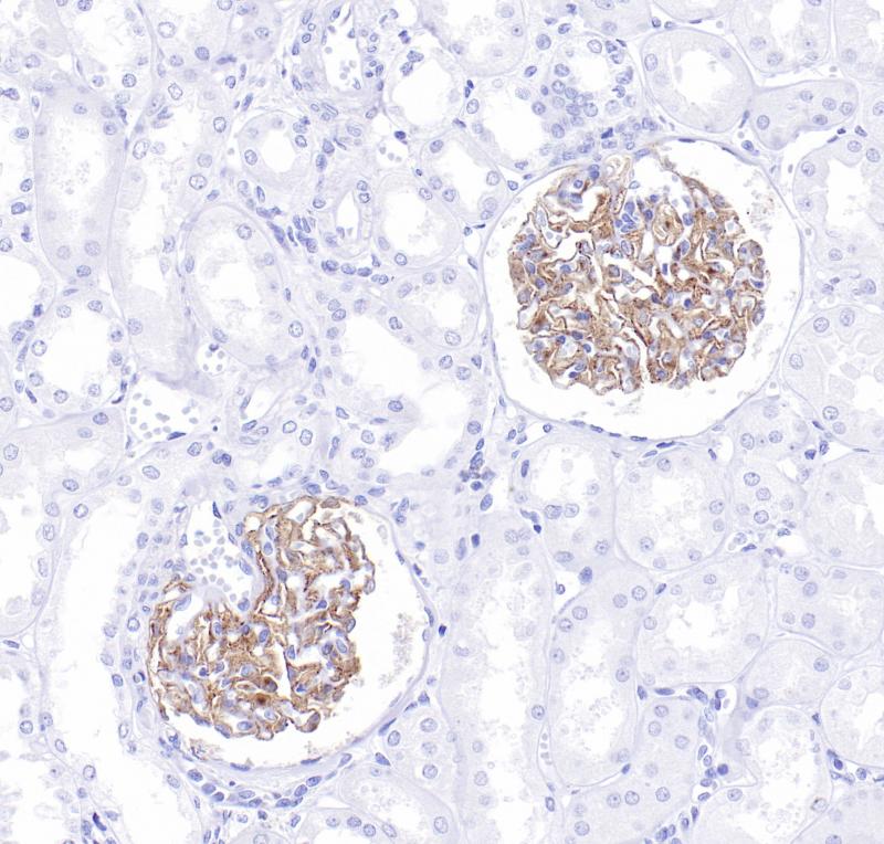 肾PLA2R(BP6284)染色