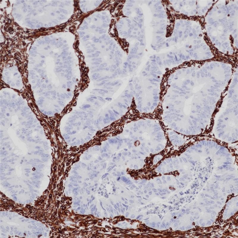 villin重组兔单克隆抗体